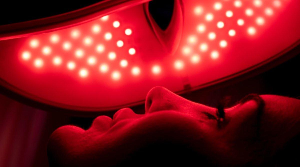 Red light therapy for acne scars - Kandyway