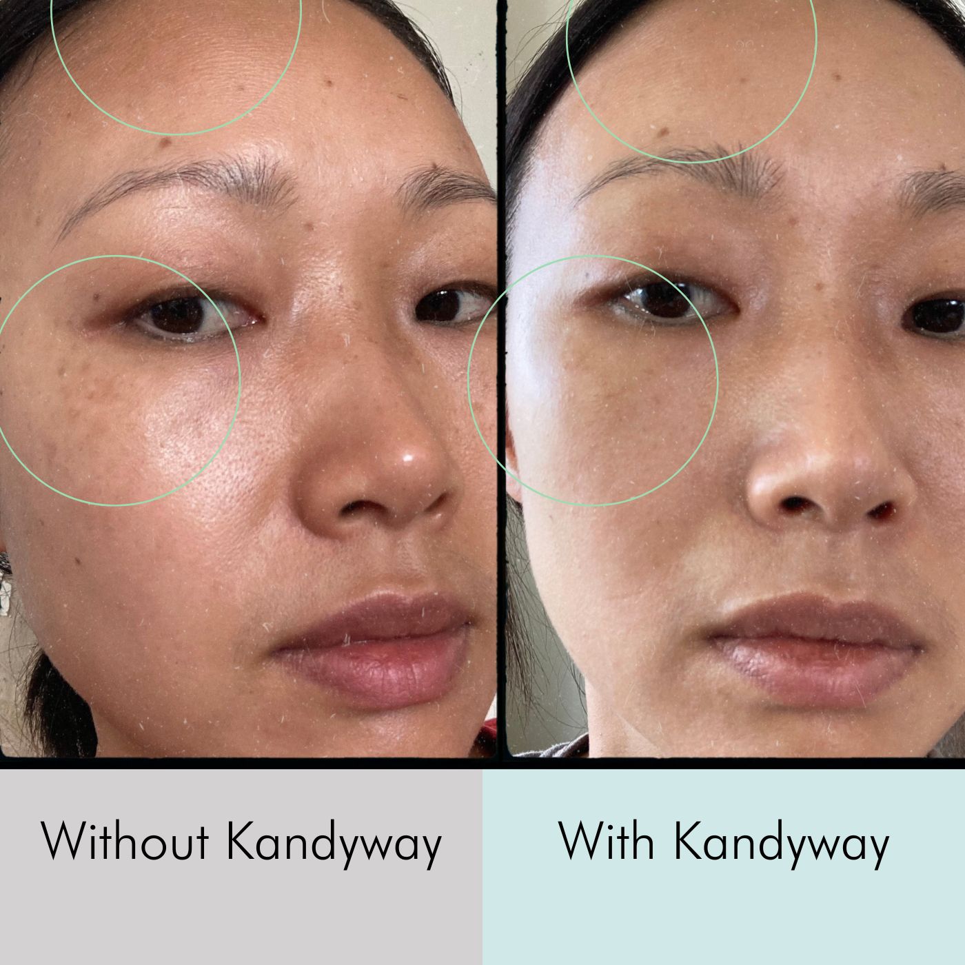 Kandyway Before and After Pictures