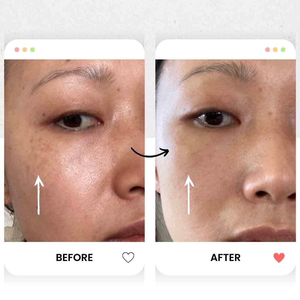 Before and after comparison of facial skin with an arrow indicating improvement.