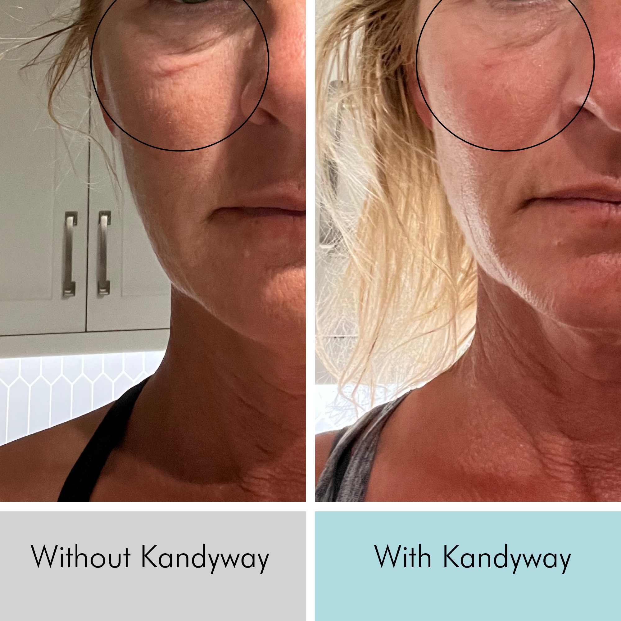 50 year old women showing wrinkle reduction under eyes