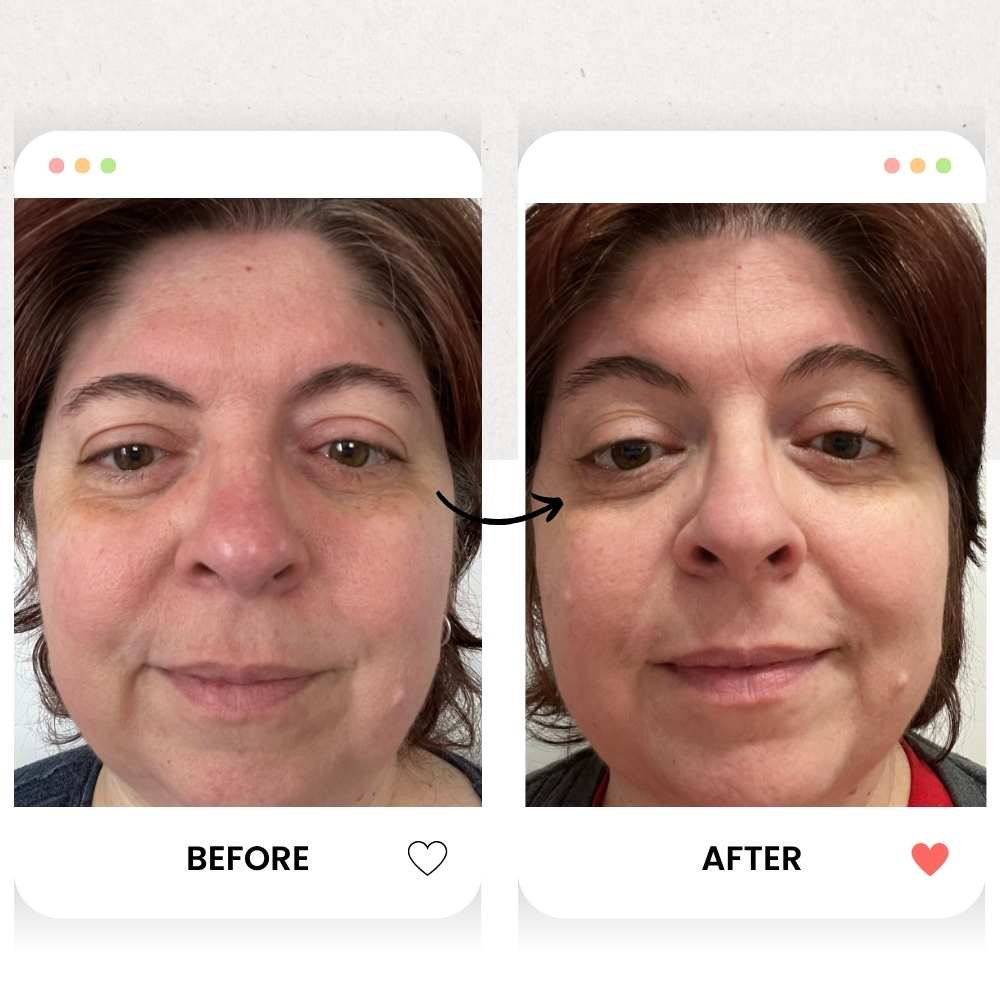 Before and after comparison of a woman's face with an arrow pointing to the 'After' side.