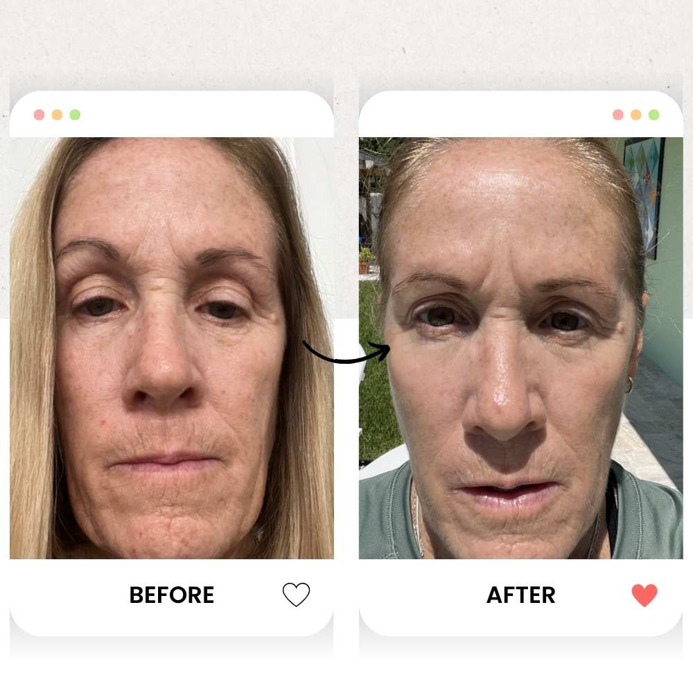 Before and after comparison of a woman's face with an arrow pointing to a specific area.