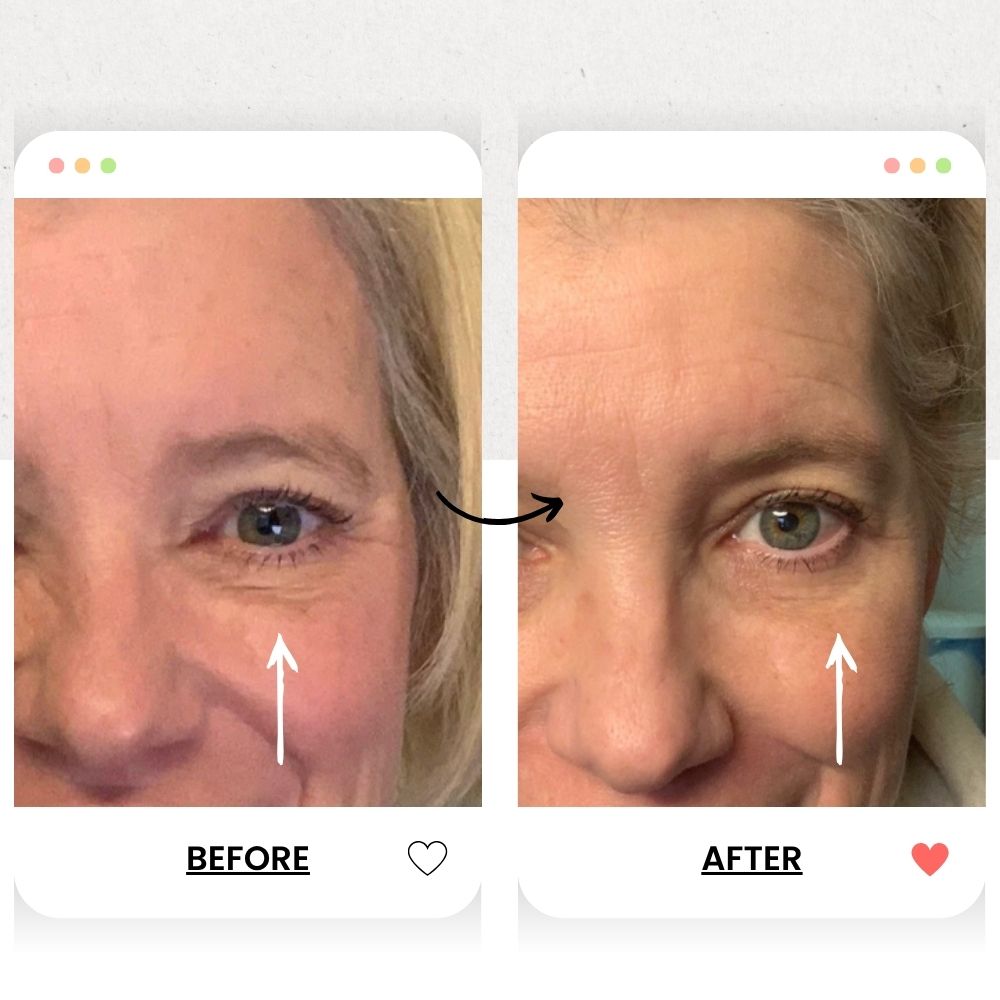 Kandyway Eternal Glow MD ™ - Red Light Therapy Mask - Kandyway