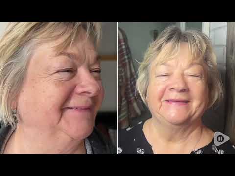 Kandyway Eternal Glow MD - Masque de Thérapie Par La Lumière Rouge LED 