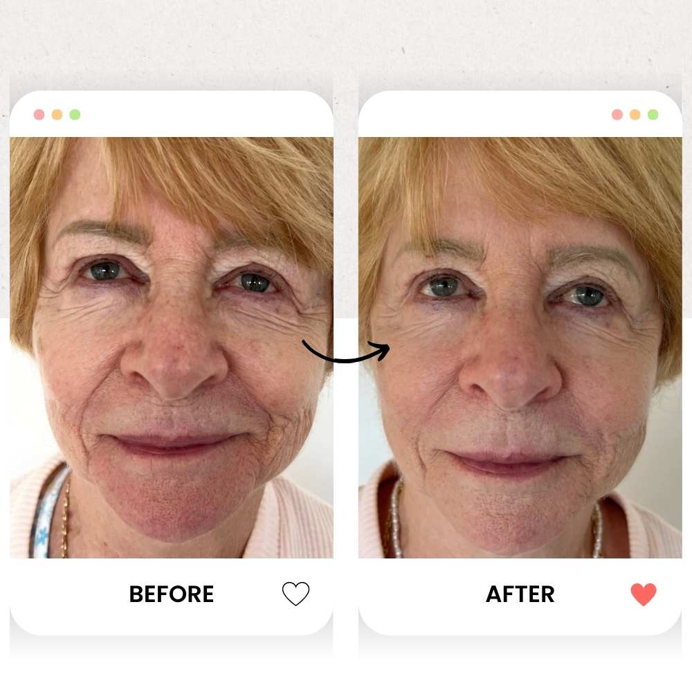 The Rejuvenate & Hydrate Red Light Therapy Pro Bundle - Kandyway