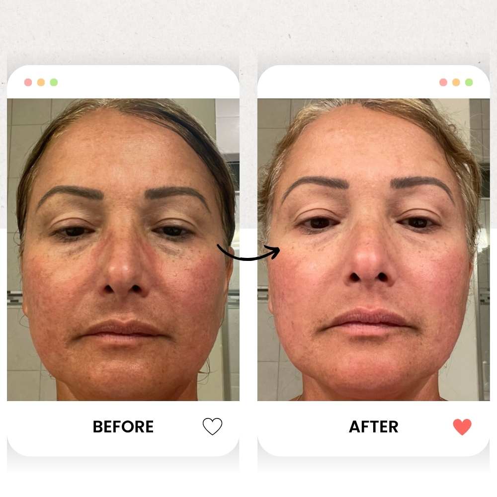 The Rejuvenate & Hydrate Red Light Therapy Pro Bundle - Kandyway